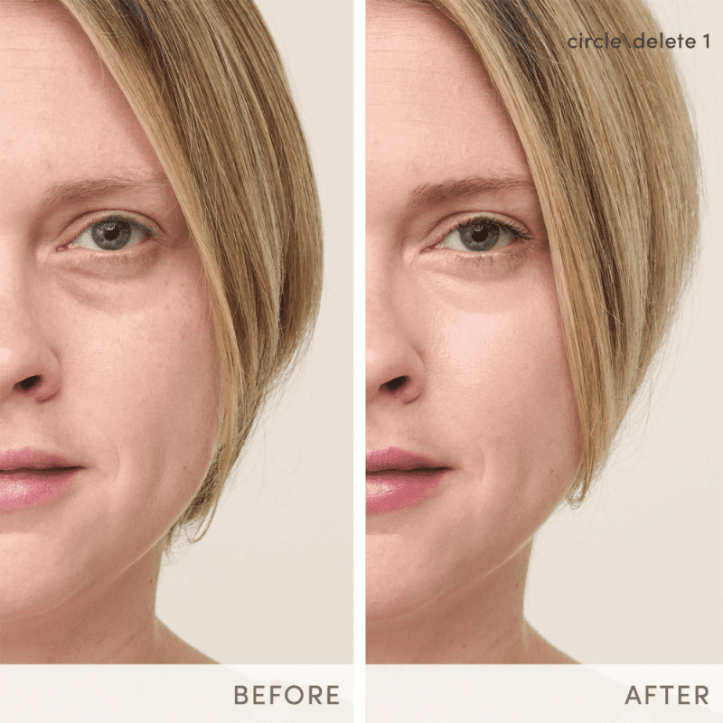 Jane Iredale CircleDelete Concealer Before After1 Shop At Skin Type Solutions