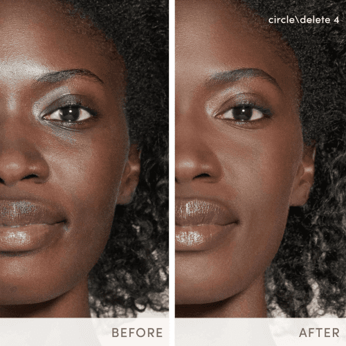 Jane Iredale CircleDelete Concealer Before After4 Shop At Skin Type Solutions