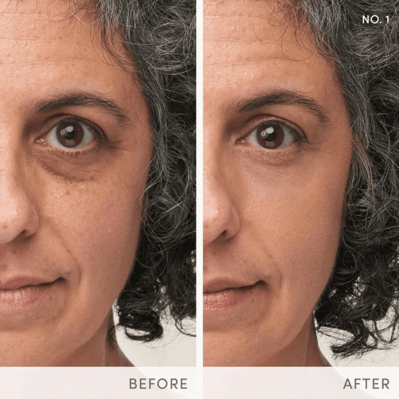 Jane Iredale Enlighten Plus Concealer Before After1 Shop At Skin Type Solutions