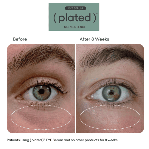 Plated EyeSerum B A