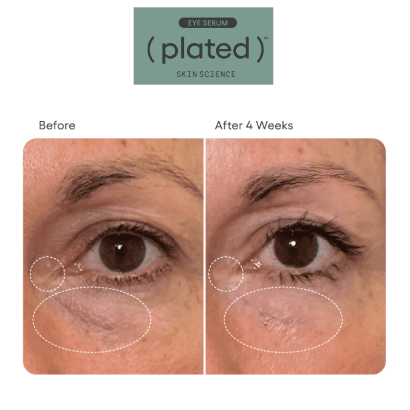 Plated EyeSerum B A 2