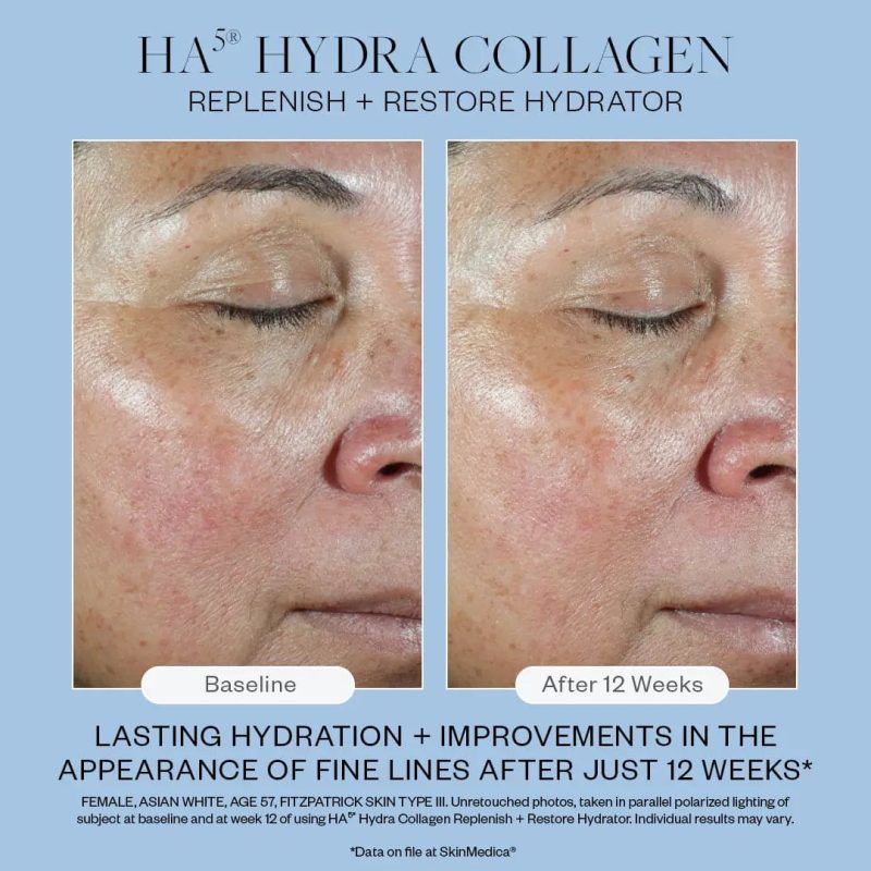 skinmedica ha5 hydra collagen replenish restore shop at skin type solutions 8