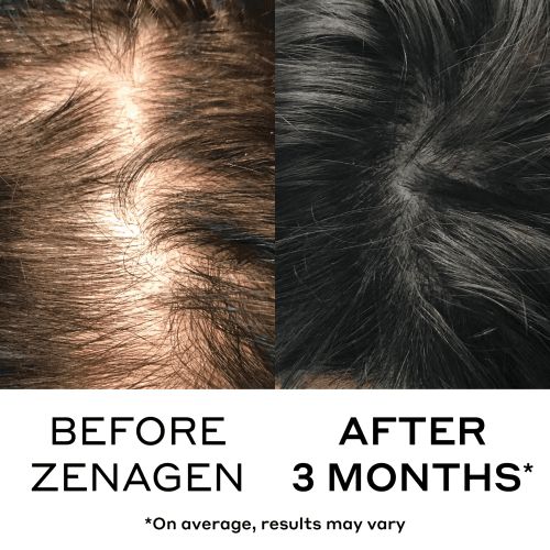 zenagen densifying hair serum hair