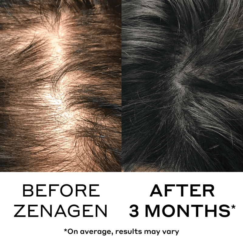 zenagen densifying hair serum hair